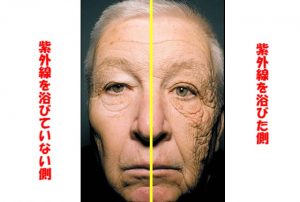 太陽老化とは何ですか？